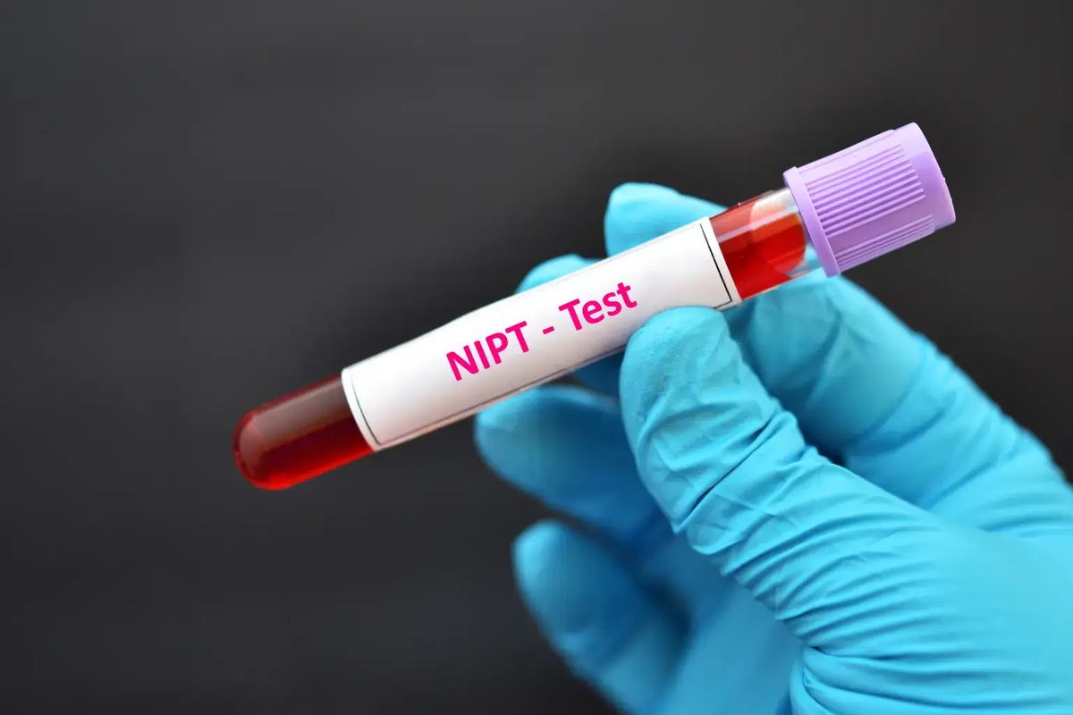 NIPT (Non-Invasive Prenatal Testing)
